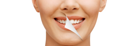 which is the best over the counter teeth whitening product